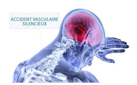 ICT ou AVS =  crise d'épilepsie
