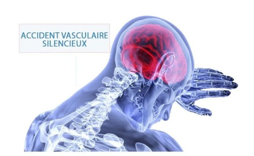 ICT ou AVS =  crise d'épilepsie