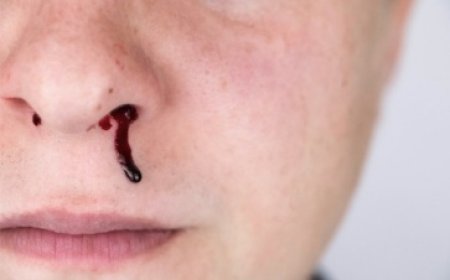 Comment enlever un caillot de sang dans le nez ?