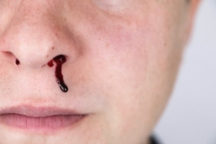 Comment enlever un caillot de sang dans le nez ?
