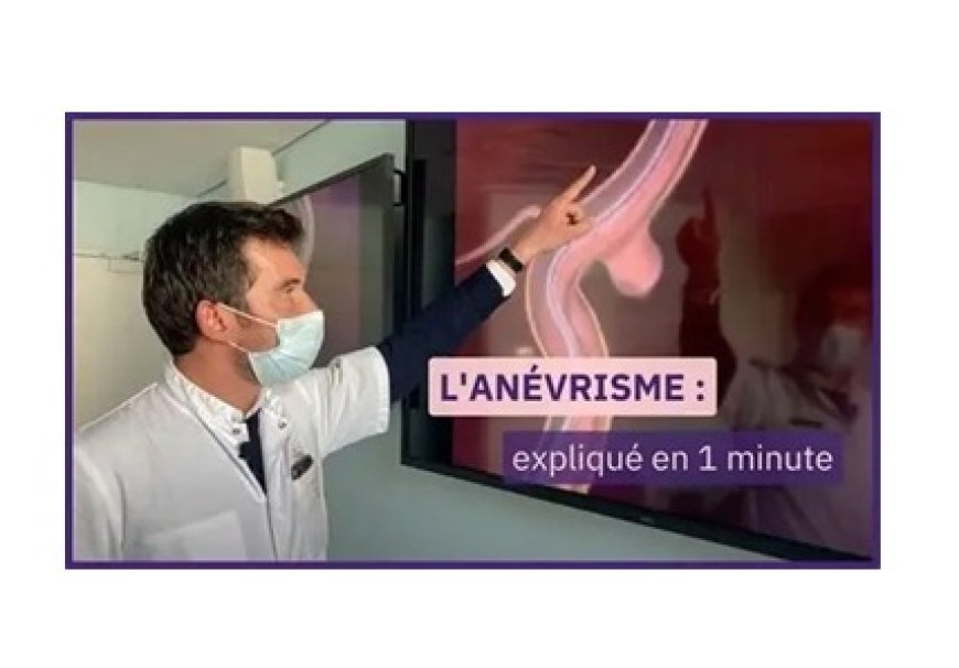 Anévrisme : une dilatation anormale de la paroi d’une artère