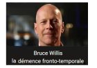 Qu’est‑ce que la démence fronto-temporale (DFT) ?