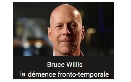 Qu’est‑ce que la démence fronto-temporale (DFT) ?